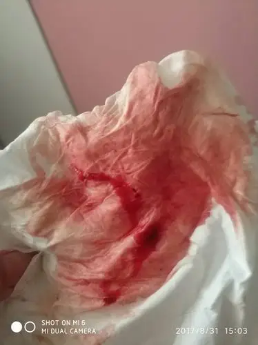 帮我看看月经性状正常吗?