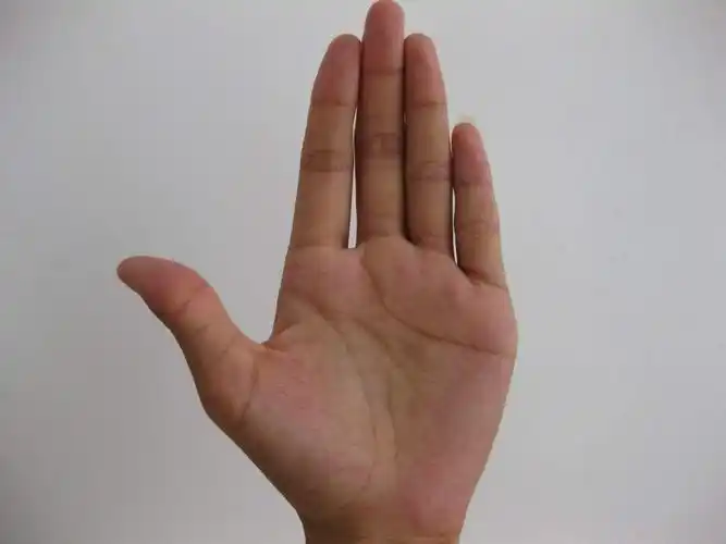 手掌鼓起肉棱图片(手掌突出一块肉鼓鼓 按下疼)