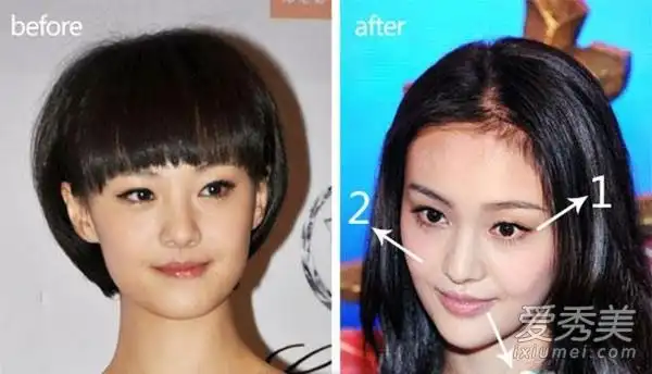 郑爽开眼角前后对比照片