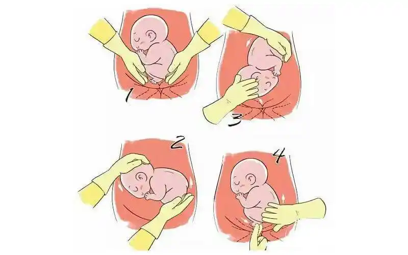 38周最快的胎儿横位转头位有哪些方法