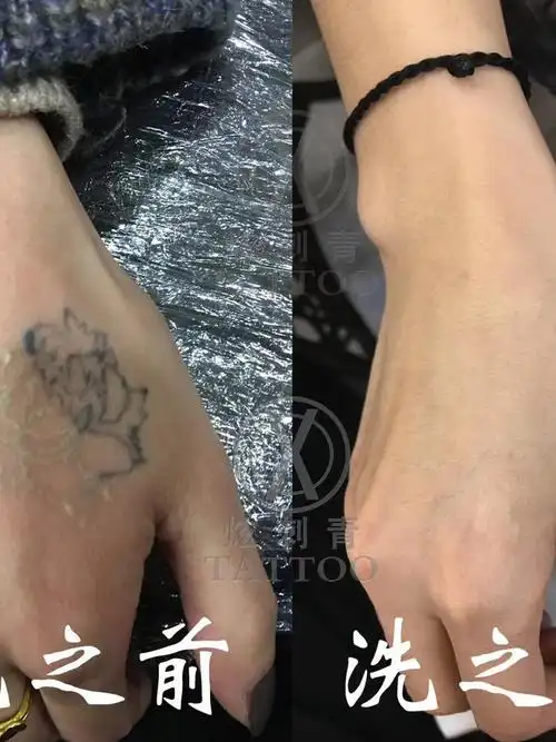 洗纹身对比效果图_纹身图案手稿图片_阿飞的纹身作品集