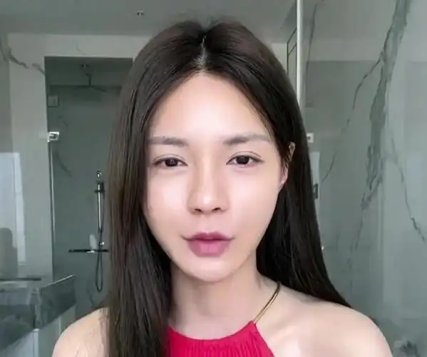 沈梦辰素颜被嘲像男人鼻头肿胀山根明显脸上惊现多处整容疤痕