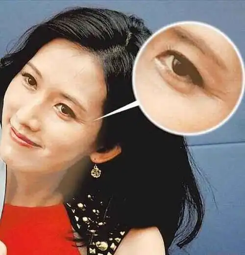 鱼尾纹严重的明星,肖战太劳累让人心疼,杨幂少女人设不保