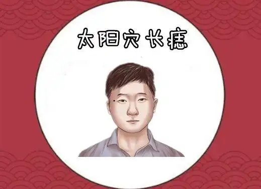 "万里挑一的5颗痣",只要一个,男人马上走运,女人必定发财!_网易订阅