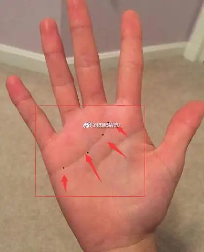 感情线上有痣代表的寓意不同 1小指下方. 来自相面法师v - 微博