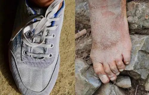 "穿越贫困"的童年