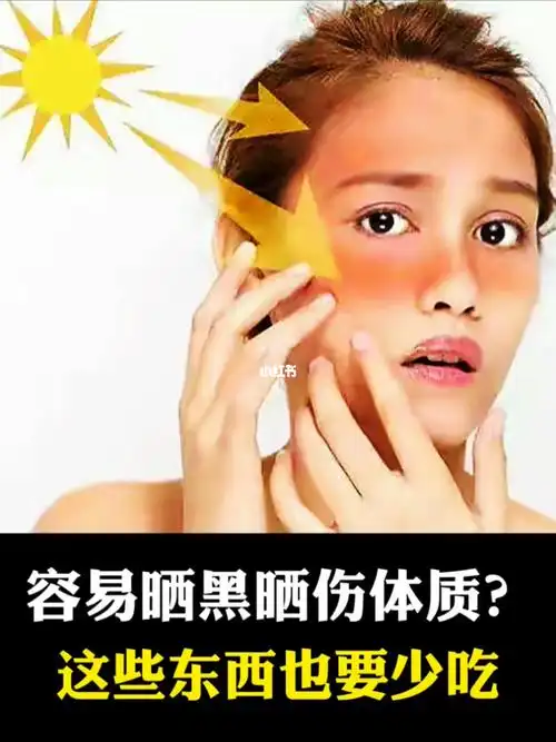 容易晒黑晒伤体质这些东西也要少吃