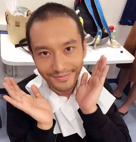 图明星黄晓明脱发照片没想到他植发了