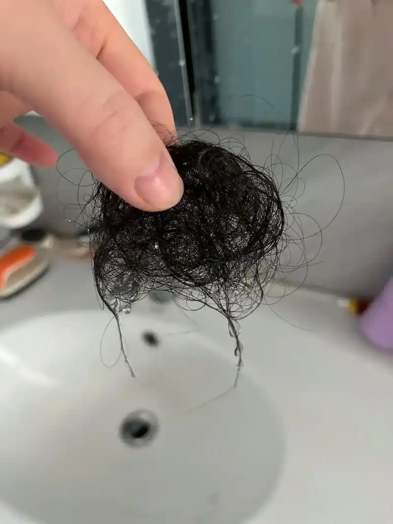 产后脱发.11月生宝宝的姐妹们,你们的头发还在么?孩认娘,发 - 抖音