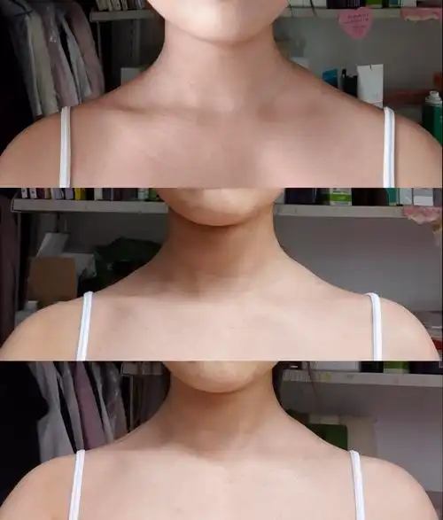 女生斜方肌怎么消除