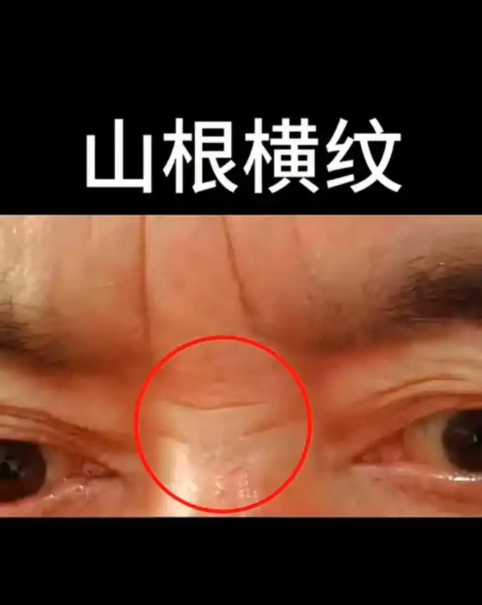 腊八节快乐…善男信女.鼻根又称山根,如果山根有横纹的话,则是 - 抖音