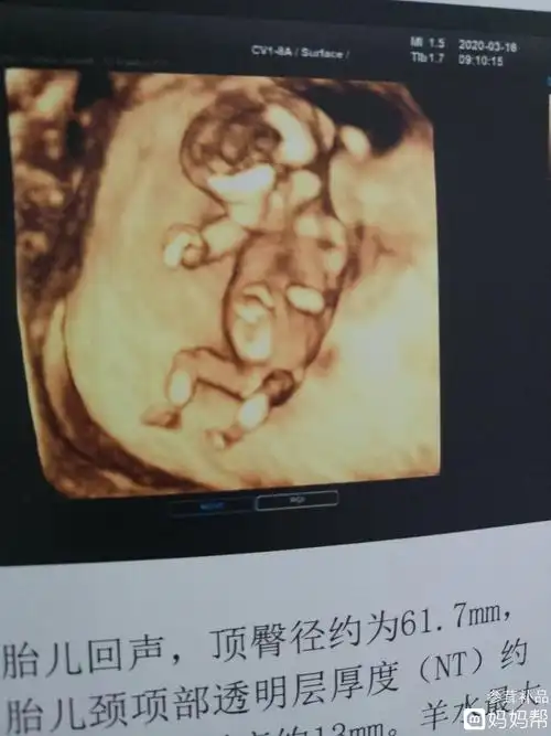 nt成功,看得出男宝女宝么?