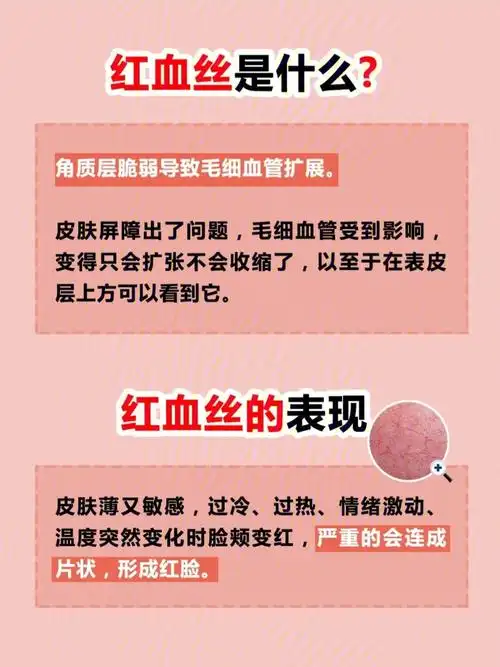 敏感肌祛红血丝养好屏障的秘密92