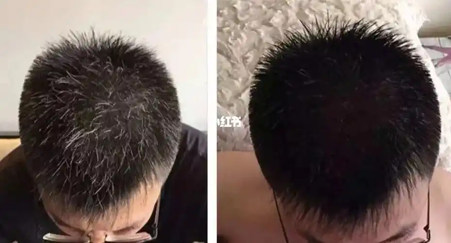 说好的白头偕老你却三年就白了头