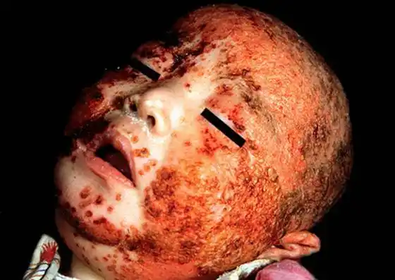 病毒性皮肤病_资讯_大夫e站