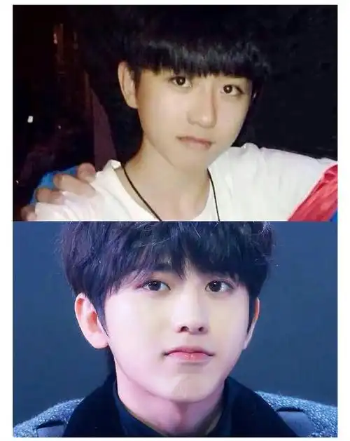 蔡徐坤前经纪公司倒油放出整容明细,但其实演艺圈明星整容不整容的