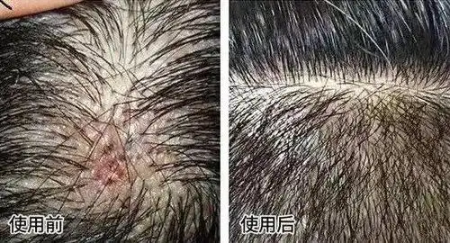 想要头发好,头皮护理到位了吗?