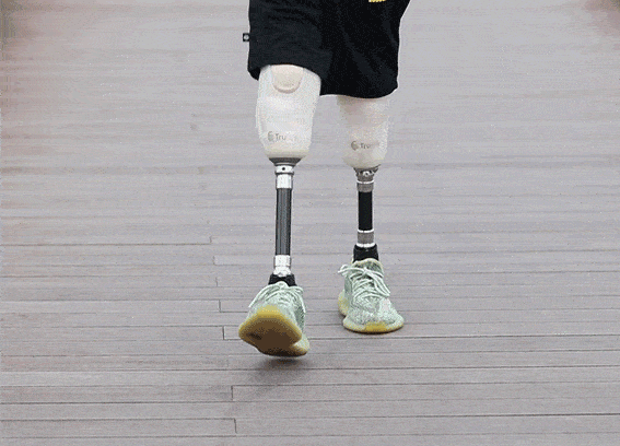 腿部截肢者如何保持平衡