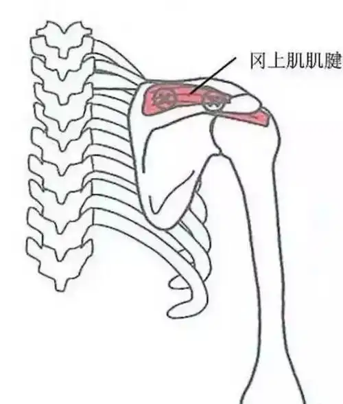 冈上肌肌腱压痛点