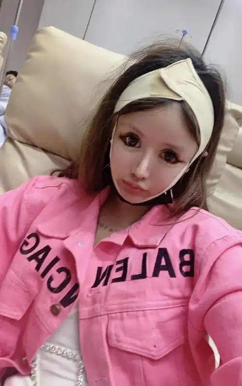 13岁开始整容15岁变蛇精脸渴望变成虞书欣就为了博取流量赚钱