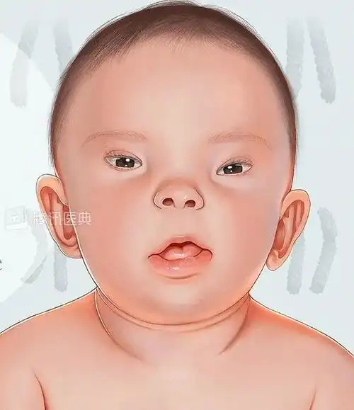 看,这只猫长得好怪,是唐氏儿吗?