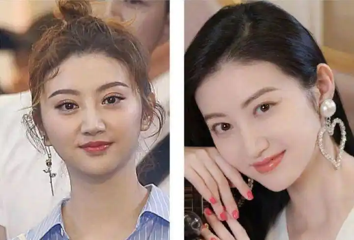 现在她终于找到适合自己的本命双眼皮—外宽内窄的新月型双