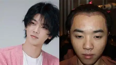 华晨宇整容还植发早年旧照视频曝光相貌与现在判若两人