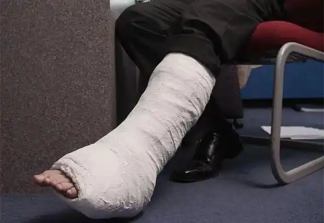 法务助残临时工干活时摔断腿老板可因没劳动合同而不管么