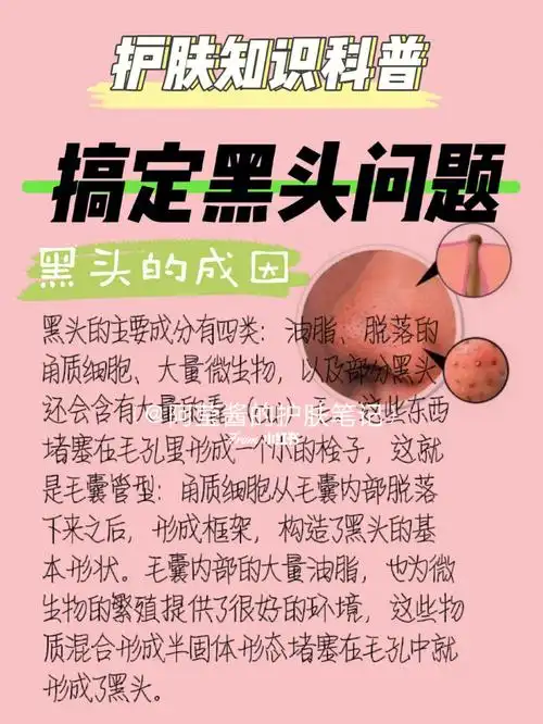 黑头姐妹必看有效去除黑头的三个阶段