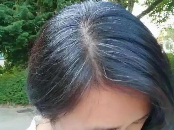 白头发是缺什么营养造成的(为什么白头发越长越多)(2)