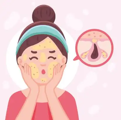 时间:06-17手绘油性皮肤问题矢量素材时间:06-17卡通油性皮肤问题矢量