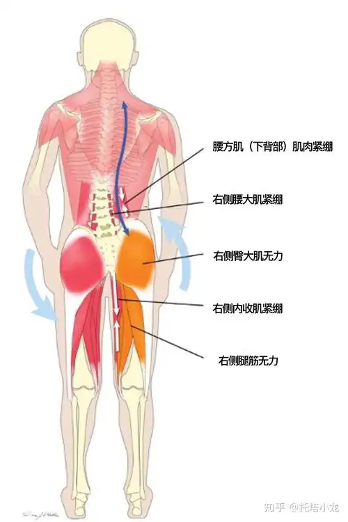 背部肌肉功能障碍及自我评估方法