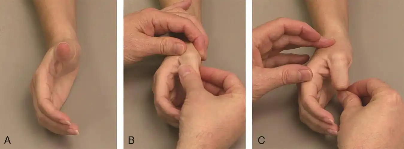 拇指的屈伸(点击在线观看检查教程)拇指对掌(点击在线观看检查教程)