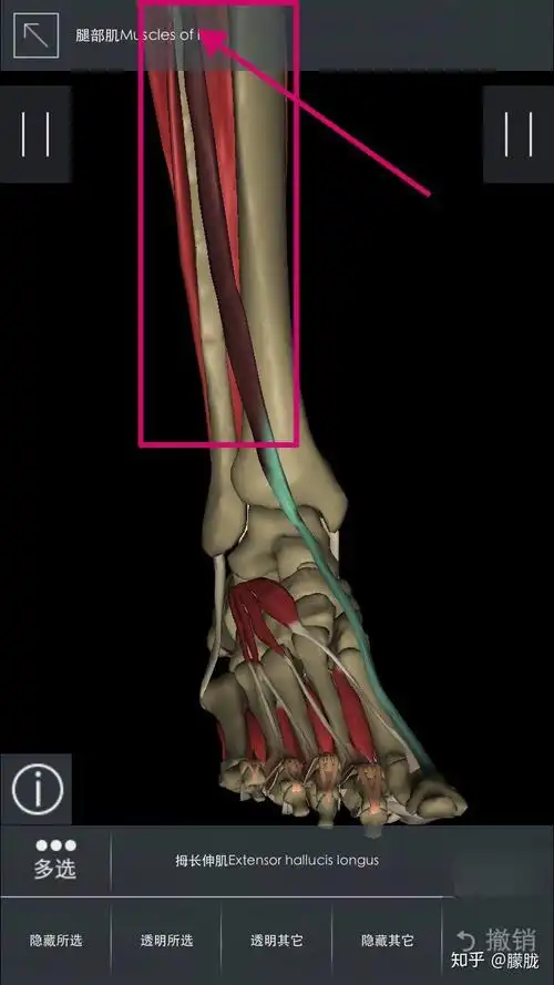 脚背拇长伸肌疼是什么原因怎么办
