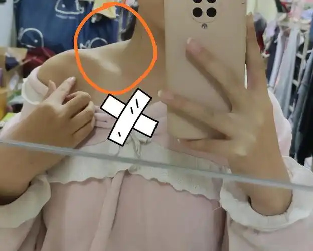 姐妹们能不能帮我看一下这是富贵包吗 还是斜方肌太.