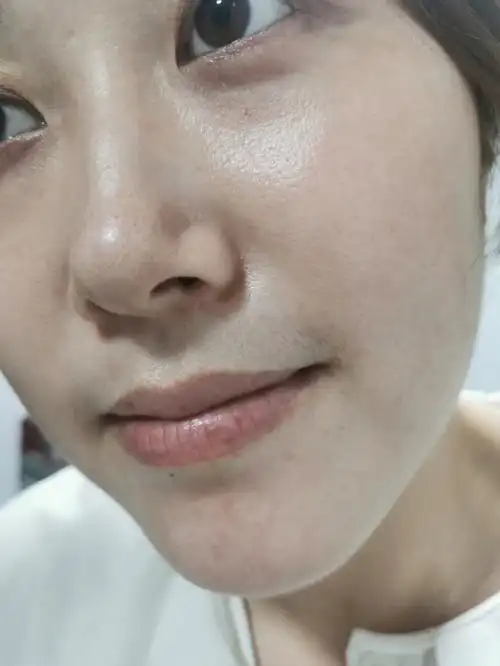 我脸终于出油了