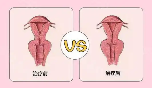 惠合嘉美齐敏院长做的私密紧缩手术安全吗?