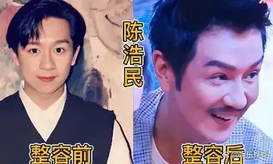 那些整了容的男明星,忍了古天乐和陈浩民,看到毛宁我忍不住了