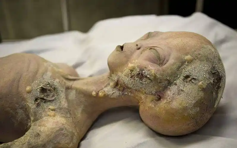 100万美元起拍!外星人解剖证据被拍卖,罗斯威尔事件真相如何