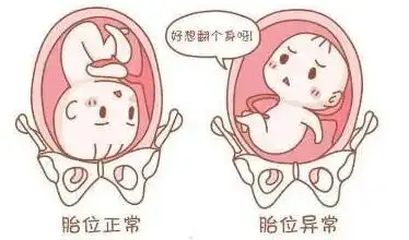 决定顺产的因素有很多,胎位便是其一,胎位也有很多种,唯一适合顺产的