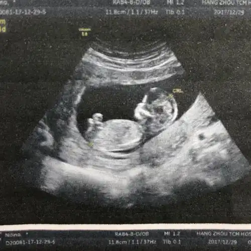 nt—你人生的第一张照片