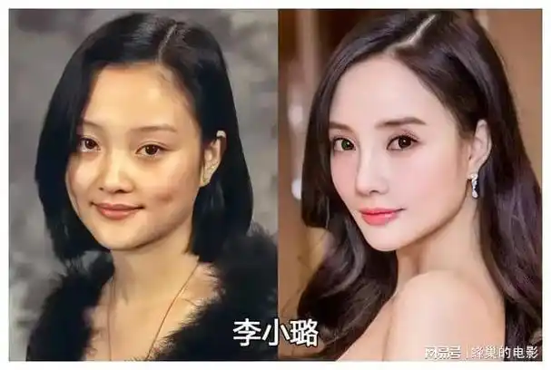 明星整容失败,你觉得他们变得更好看了吗?