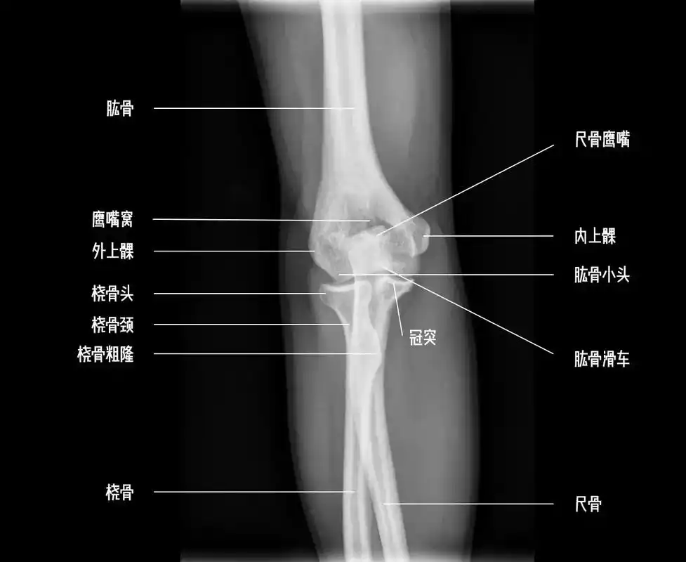 肘关节解剖.#解剖 #肘关节 #医学影像 #医学生 #医生日 - 抖音