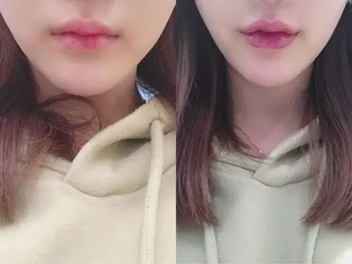 去探店|如何拥有性感嘟嘟唇