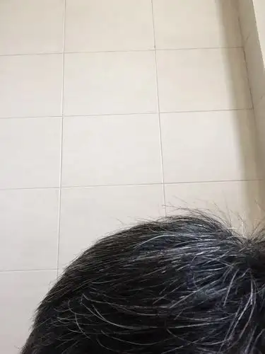 主题:我35岁,头发85%都是白头发,有和我一样的吗?