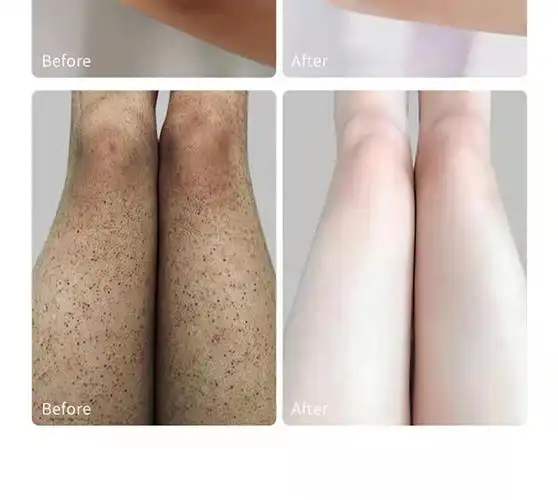 3瓶针对黄黑皮buv黑莓焕肤磨砂膏去角质去死皮鸡皮肤光滑身体乳保湿