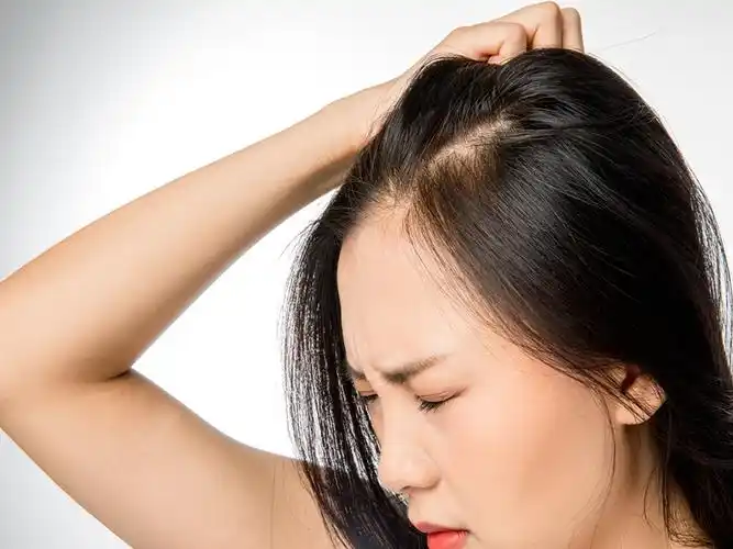 什么洗发水治头痒效果好