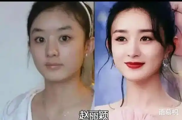 娱乐圈就是整容场开挂式逆袭明星出道前后对比你认出了几个