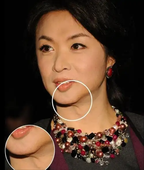 金星"变性手术"终于有副作用了