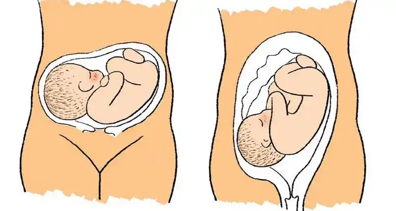 怀儿子的特征怀儿子有哪些症状